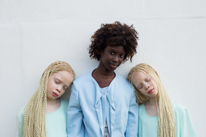 Lara y Mara: las gemelas albinas que están revolucionando el mundo ...