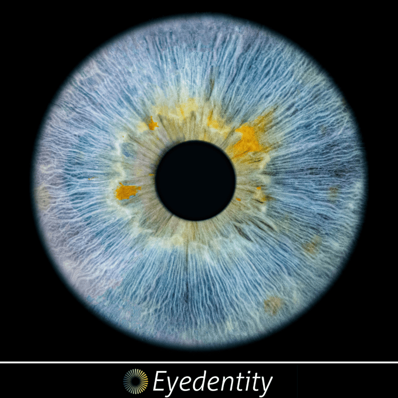 EYEDENTITY