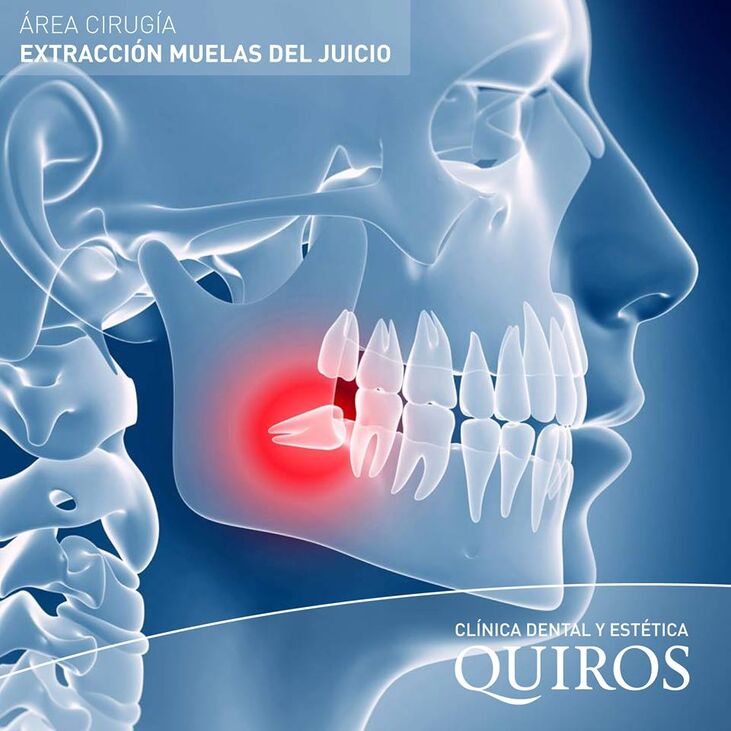Clínica Dental y Estética Quiros