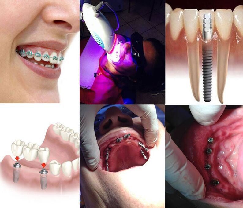 Clínica Dental Miscanti